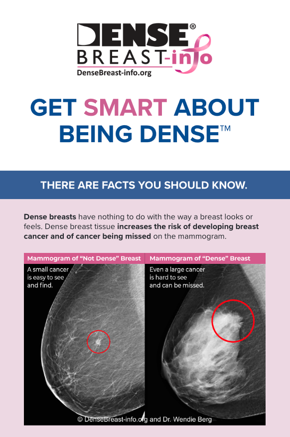 Dense-Breast-Info-Patient-Brochure
