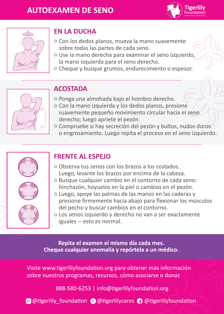 Breast Self Exam (Spanish)